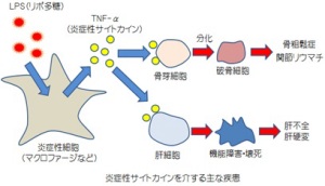 炎症性サイトカインを介する主な疾患