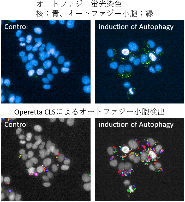 オートファジーの蛍光染色写真とOperetta CLSによるオートファジー小胞検出