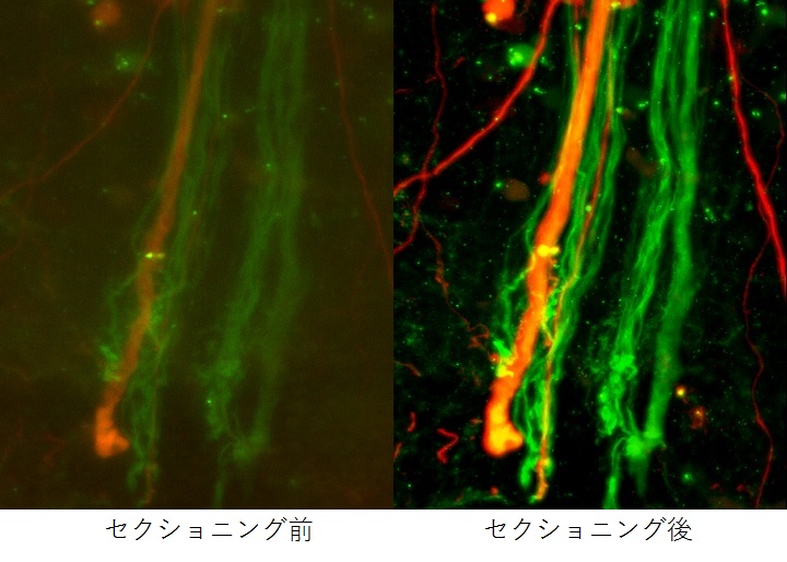 蛍光写真のセクショニング前とセクショニング後の比較